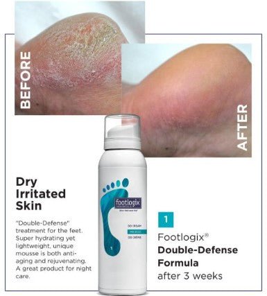 Footlogix 1 DD cream mousse formula - Footlogix - U - tools