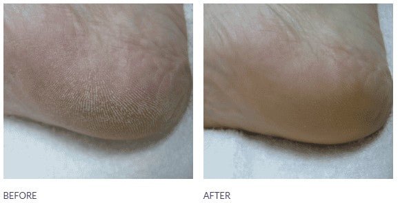 Footlogix 2 Daily Maintenance Formula - Footlogix - U - tools